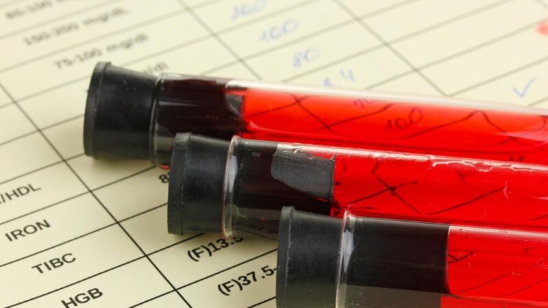 Czy dziecko może mieć inną grupę krwi niż rodzice – wyjaśnienie dziedziczenia