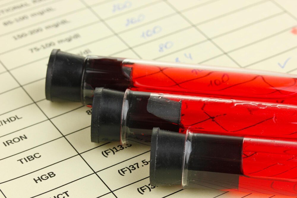 Czy dziecko może mieć inną grupę krwi niż rodzice – wyjaśnienie dziedziczenia