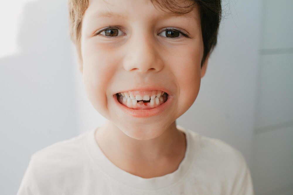 Po jakim czasie od wypadnięcia mleczaków rosną zęby stałe