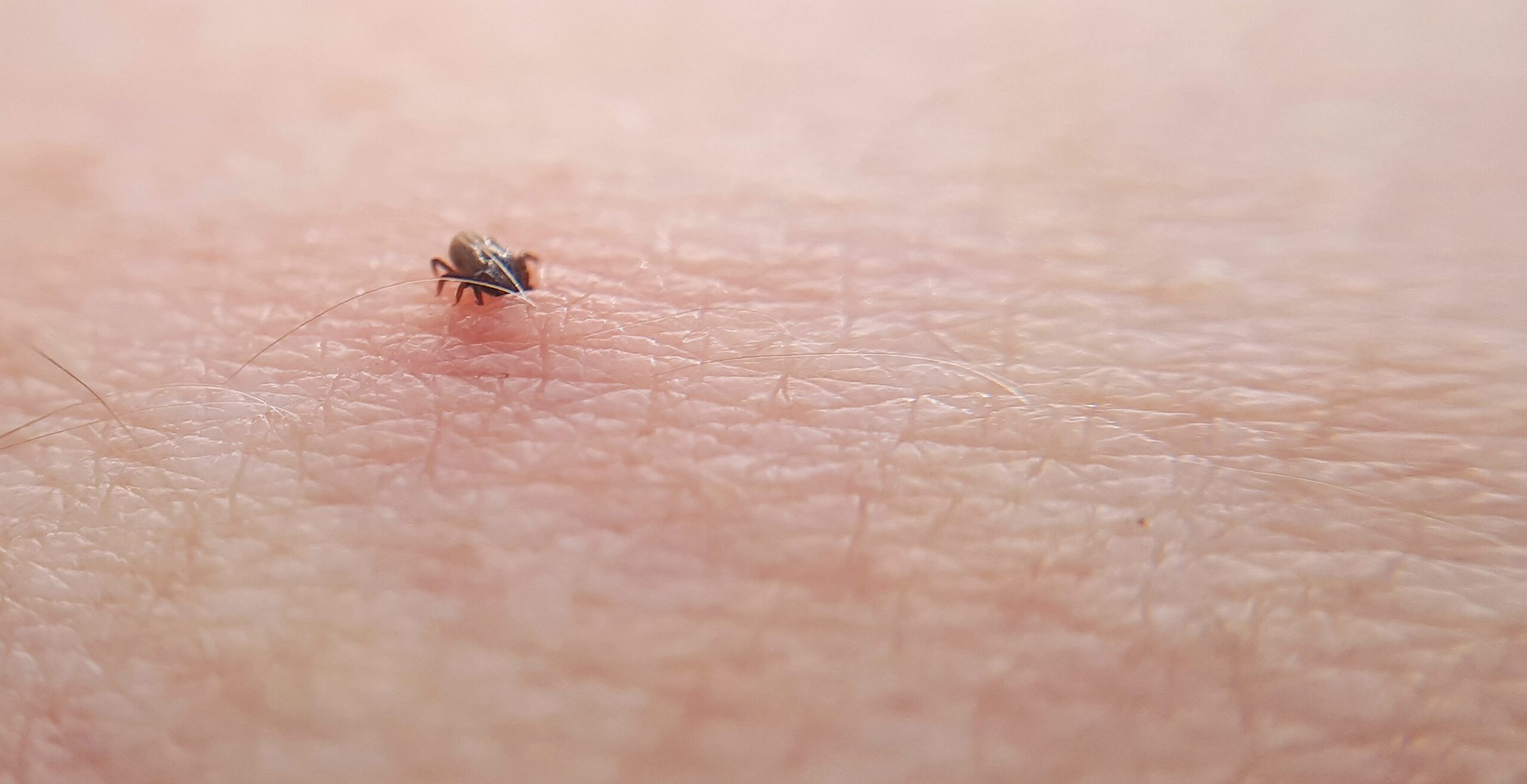 Niepokojące objawy po kleszczu – dlaczego pojawiają się dopiero po tygodniach?